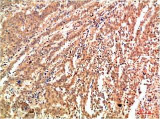 MAPK9 Antibody