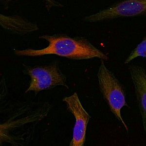 MAPKAPK2 Antibody