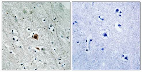 MAPKAPK2 (Phospho-Ser272) Antibody