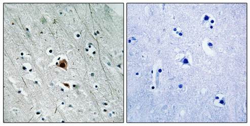 MAPKAPK2 (phospho-Ser272) antibody