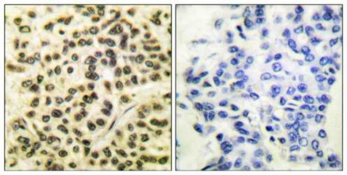 MAPKAPK2 (phospho-Thr334) antibody