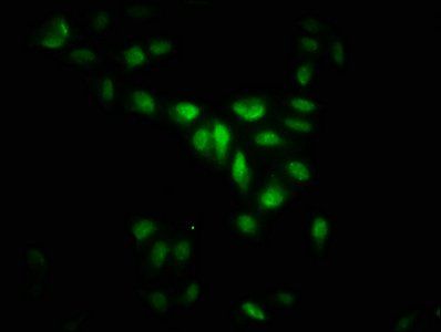 MAPKAPK5 Antibody
