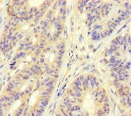 MAPRE1 Antibody
