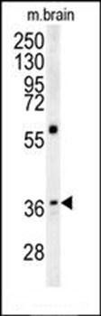 MAPRE1 antibody