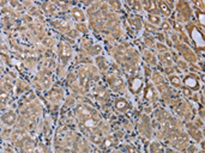 MAPRE3 antibody