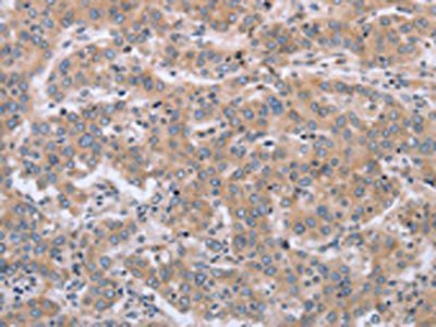 MAPRE3 antibody