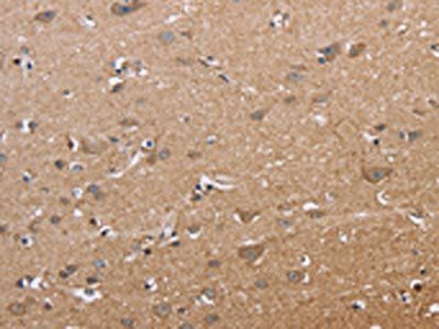 MAPRE3 Antibody