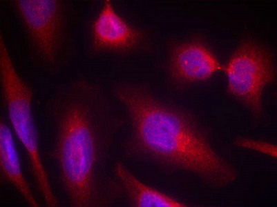 MAPT Antibody