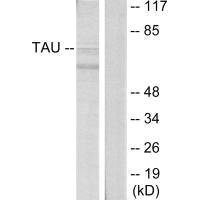 MAPT (Ab-396) antibody