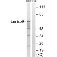 MAPT Antibody