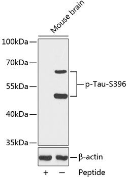 MAPT (Phospho-S396) antibody