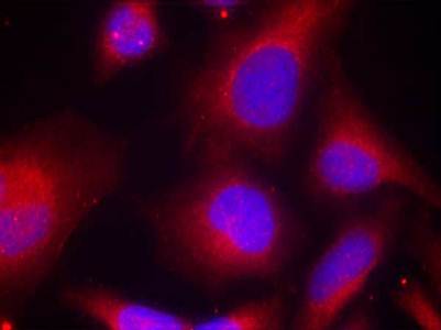 MARCKS (Phospho-Ser158) Antibody