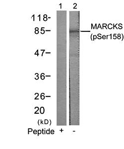 MARCKS (Phospho-Ser158) Antibody