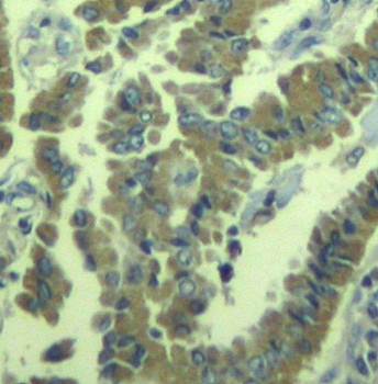 MARCKS (phospho-Ser170) Antibody