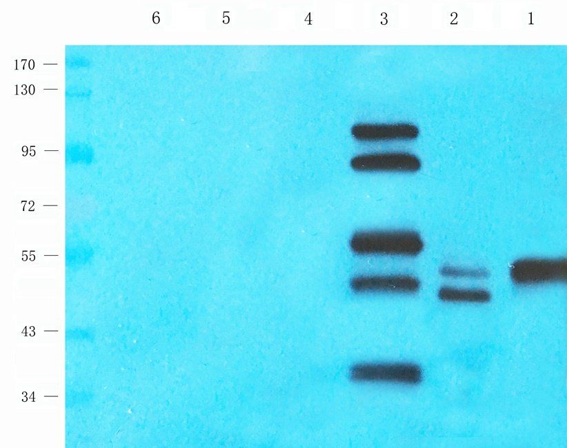 MARCO antibody