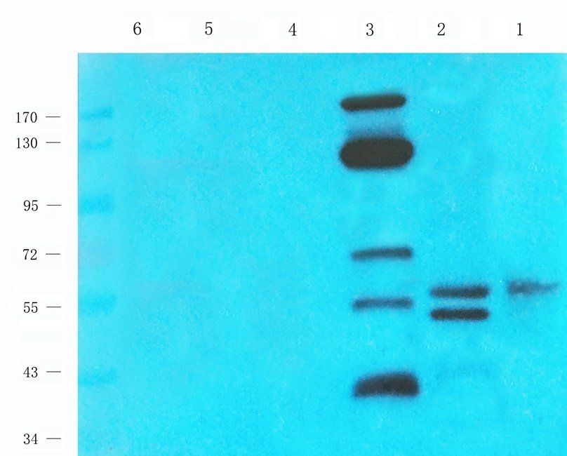 MARCO antibody