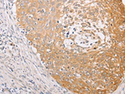 MARK1 Antibody
