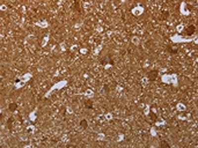 MARK1 Antibody