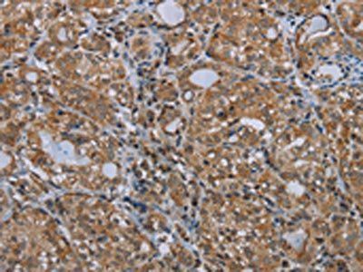 MARK1 Antibody