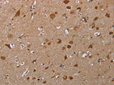 MARK1 Antibody