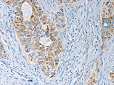 MARK2 Antibody