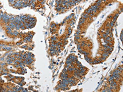 MARK2 Antibody