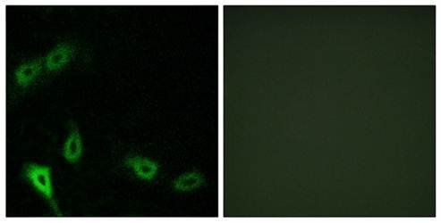 MARK2 Antibody