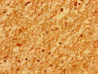 MARS2 Antibody