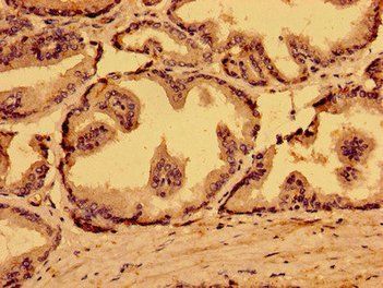 MARS2 Antibody
