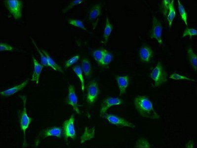 MAS1 antibody