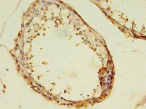 MAS1 Antibody