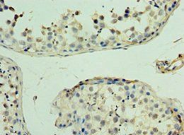 MAS1 Antibody