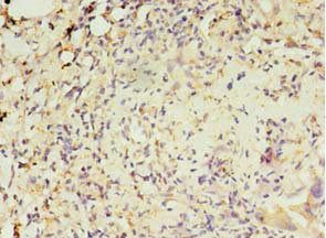 MAS1L antibody