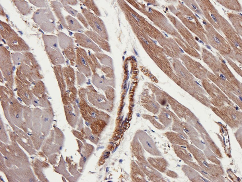 MASP2 antibody