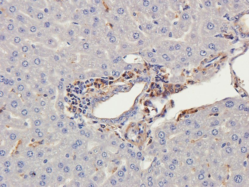 MASP2 antibody