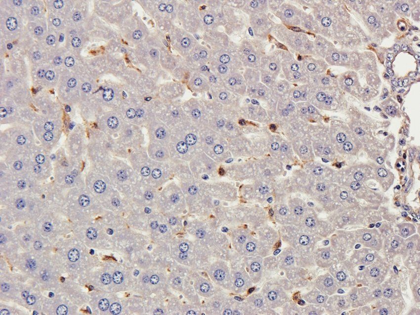 MASP2 antibody
