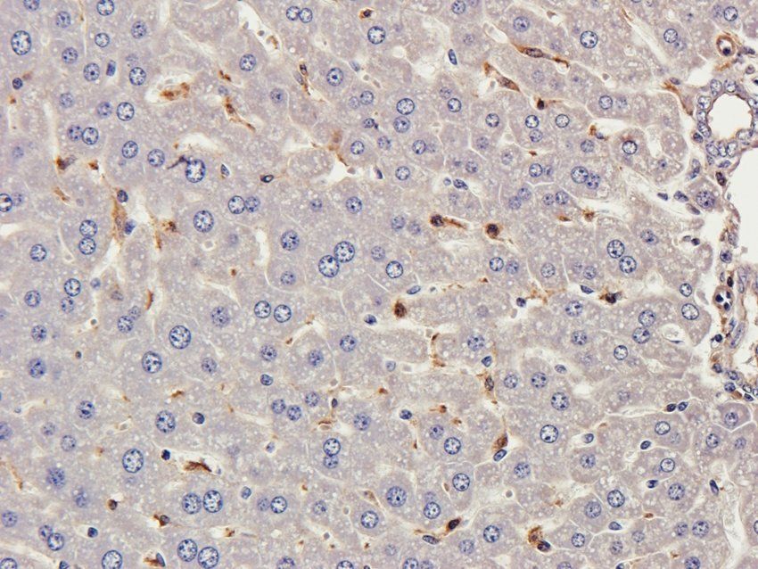 MASP2 antibody