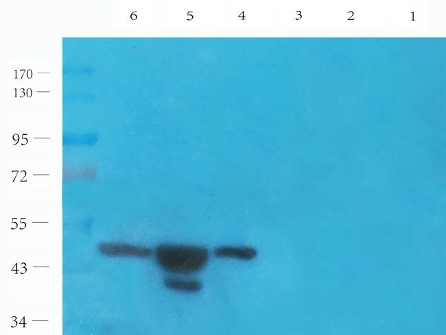 MASP2 antibody