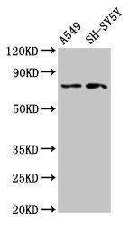MASP2 antibody
