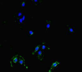 MAST1 antibody