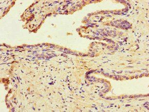 MAST1 Antibody