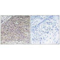 MAST4 Antibody