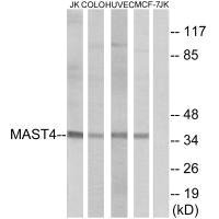 MAST4 Antibody
