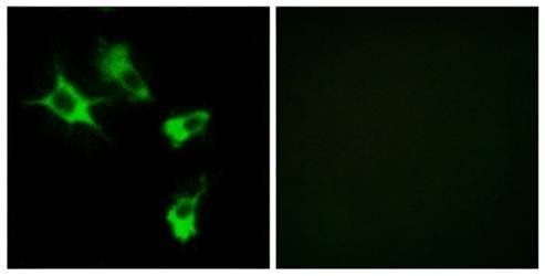 MAST4 Antibody