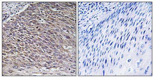MAST4 Antibody