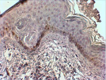 Goat anti-CMA1 Antibody