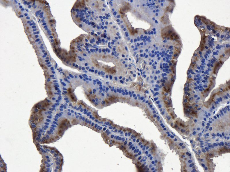 Mast Cell Chymase antibody