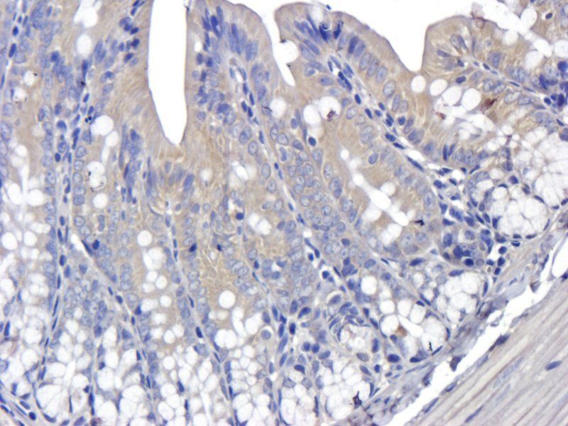 Mast Cell Chymase antibody