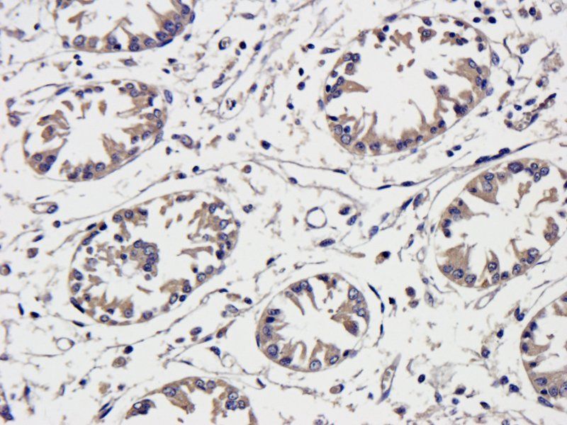 Mast Cell Chymase antibody