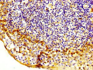 MASTL Antibody